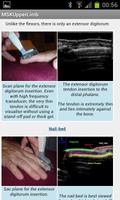 MSK ultrasound Upper Limb ảnh chụp màn hình 3