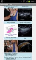 MSK ultrasound Upper Limb ảnh chụp màn hình 1