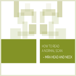 Normal Radiology: MRA Head