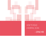 Normal Radiology: MRI Spine