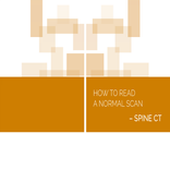Normal Radiology: Spine CT