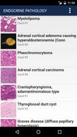Anatomic Pathology Flashcards تصوير الشاشة 2