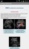 Urological Ultrasound capture d'écran 1
