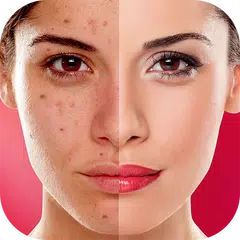 Descargar APK de Face Blemishes Cleaner & Photo Scars Remover