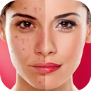APK Face Blemishes Cleaner & Photo Scars Remover