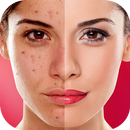 Face Blemishes Cleaner & Photo Scars Remover aplikacja