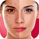 Face Blemishes Cleaner & Photo Scars Remover آئیکن