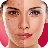 Face Blemishes Cleaner & Photo Scars Remover иконка