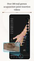 Acupuncture Master syot layar 3