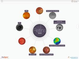 Retina Base โปสเตอร์