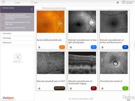 Retina Base ภาพหน้าจอ 1