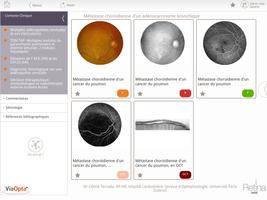 Retina Base स्क्रीनशॉट 1