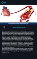 Circulatory System Anatomy capture d'écran 3
