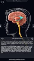 My Brain Anatomy captura de pantalla 3