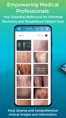 VisualDx XAPK Herunterladen