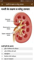 घरेलु उपचार - Home Remedies in 截圖 3