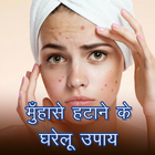 Acne and Pimples Home Remedies Zeichen