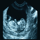 OBGYN Ultrasound Boards Flashc icône