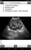 OBGYN Ultrasound Boards Flashc Affiche