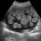 ARRT Ultrasound Cards Lite أيقونة
