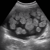 ARRT Ultrasound Cards Lite أيقونة