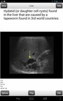 ARRT Ultrasound Cards Lite تصوير الشاشة 2