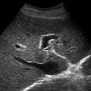 Abdomen Ultrasound Boards Flas APK