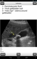 Abdomen Ultrasound Boards Flas capture d'écran 2