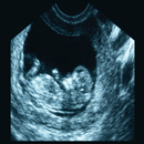 Ultrasound Abdomen OBGYN SPI B APK
