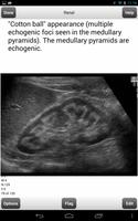 Ultrasound Flashcards Boards F पोस्टर