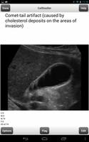 Ultrasound Flashcards Boards F скриншот 2