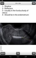 Ultrasound Flashcards Boards F تصوير الشاشة 3