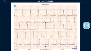 Beat2Phone ECG poster