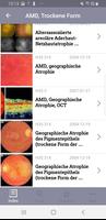 1 Schermata Atlas of Ophthalmology Onjoph