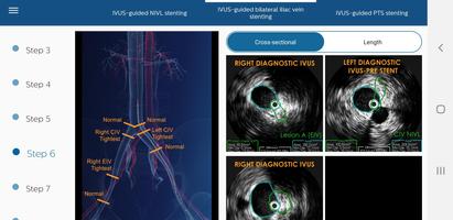 Philips Venous IVUS Tutor ảnh chụp màn hình 3