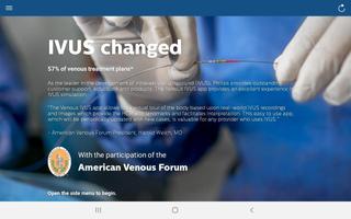 Philips Venous IVUS Tutor bài đăng