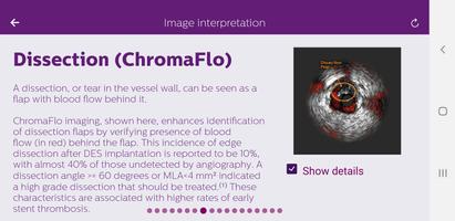 Philips Coronary IVUS Tutor ảnh chụp màn hình 1