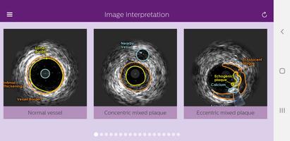 Philips Coronary IVUS Tutor ảnh chụp màn hình 3