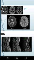 برنامه‌نما Radiologie pour tous عکس از صفحه