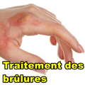 Traitement des brûlures