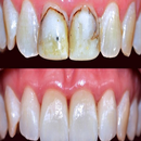 طرق علاج تسوس الاسنان APK