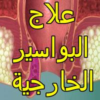 1 Schermata علاج البواسير الخارجية