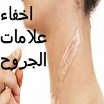 التخلص من اثار الجروح APK