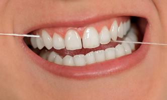 وصفات مجربة لتبييض الأسنان‎  2019 截图 2