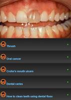 All dental diseases screenshot 3