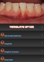 All dental diseases poster