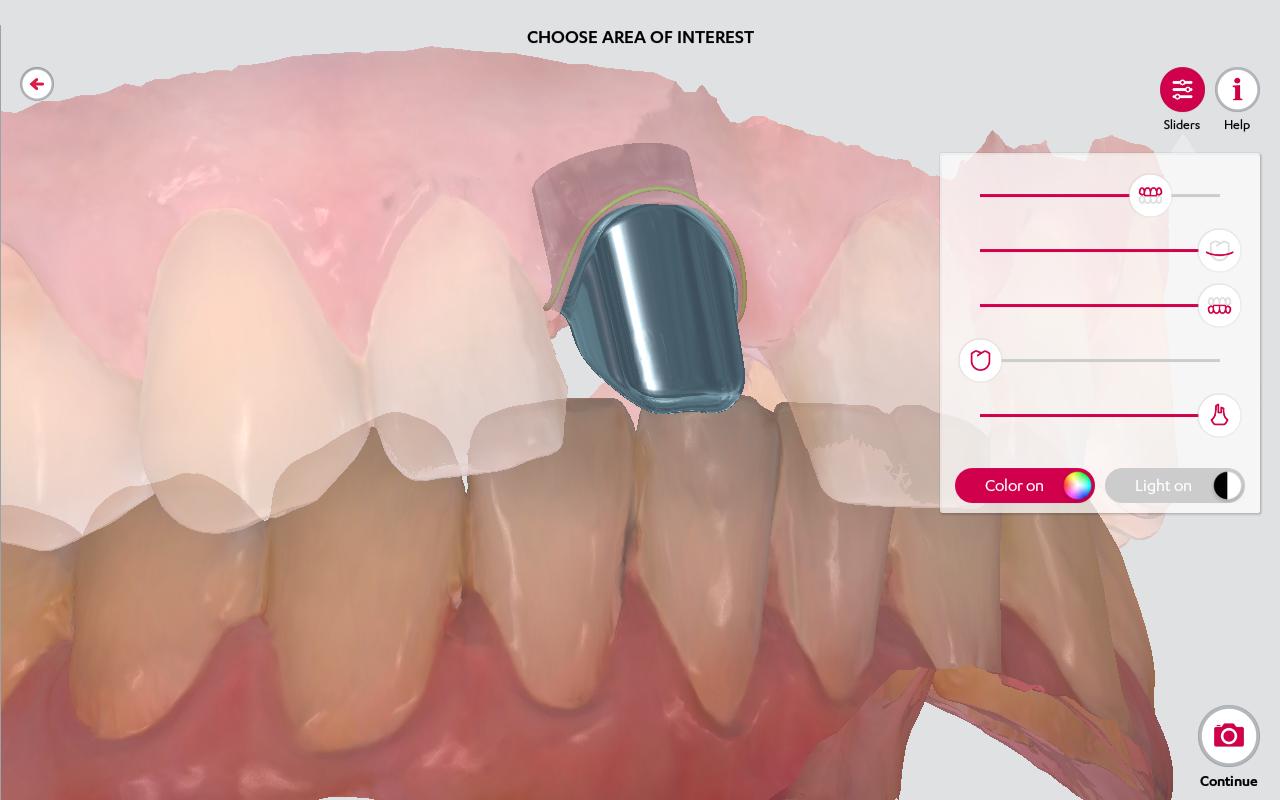 3shape support usa 3shape support usa
