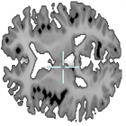 Brain viewer icono