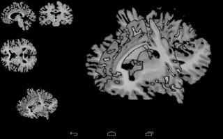 Brain viewer captura de pantalla 1