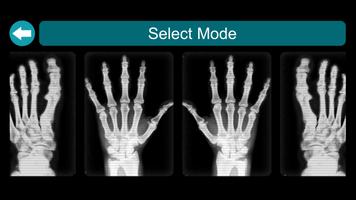 X-Ray Scanner capture d'écran 1